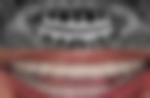 深圳优尔口腔门诊部医院顾客的口碑评价