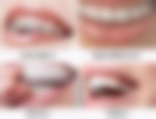 深圳辛博口腔门诊部徐林涛医生口碑评价