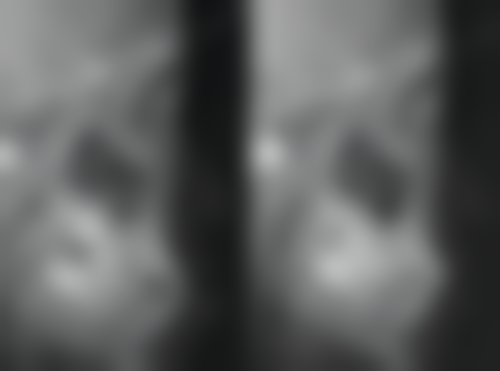 汉中职业技术学院附属医院郑治国医生的收费价格表