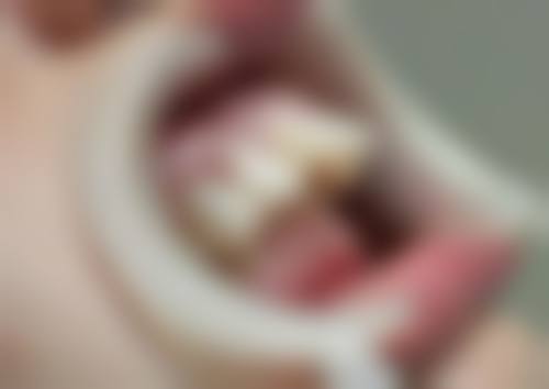 上海华美医疗美容医院张琳琳医生口碑评价