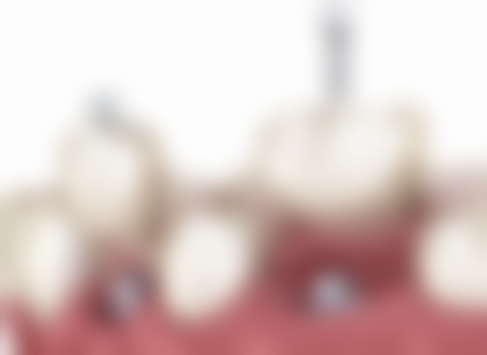 江苏盐城储瑞雷口腔门诊医院顾客的口碑评价