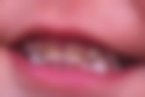 桥头德恒口腔医院项目价格