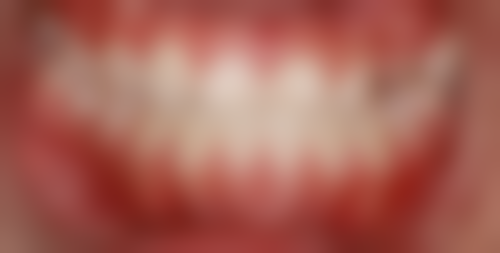 桥头德恒口腔医院开展项目