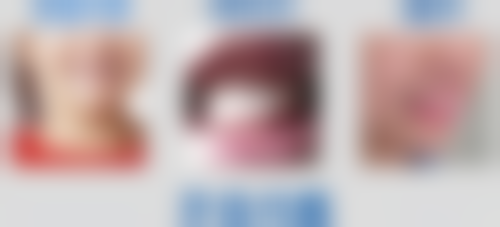 天津静海美雅口腔门诊部医院项目价格