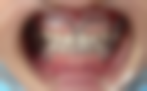 河南郏县博雅口腔门诊部医院开展项目