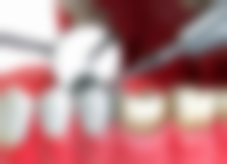 自贡小牙齿口腔诊所医院项目价格