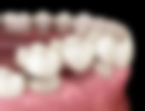 深圳致历宝口腔医院特色项目