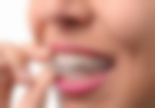 关于江西景德镇胡静口腔诊所的常见问题