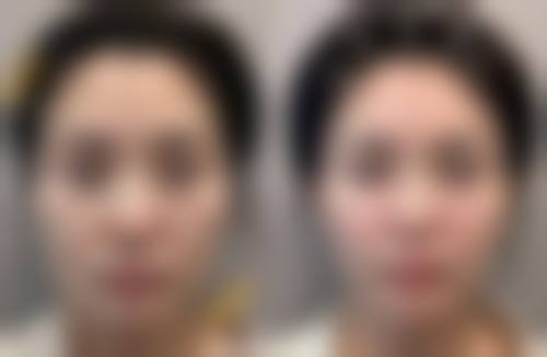 深圳恒泽医疗整形美容医院的口碑好评(真实求美者反馈)