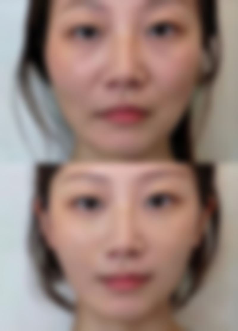 2. 祁东金典美集医疗美容诊所擅长做哪些项目?