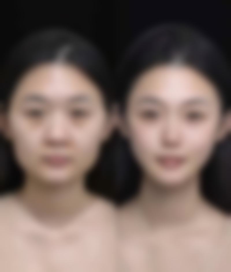 6. 祁东金典美集医疗美容诊所2026年收费价格参考
