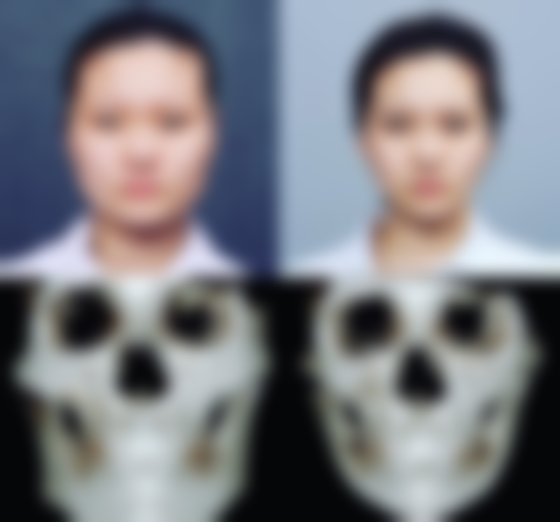 擅长项目详解